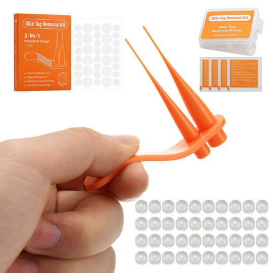 Skin Tag Remover Kit 2-7mm Skin Tag Removal Device