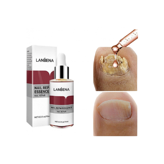 Nail Repair Essence Serum Anti Fungal Onychomycosis Treatment LANBENA