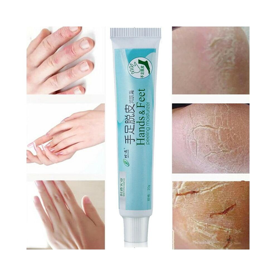 (Type) Crack Repair Cream-Heel Hand, Foot and Moisturizing Skin