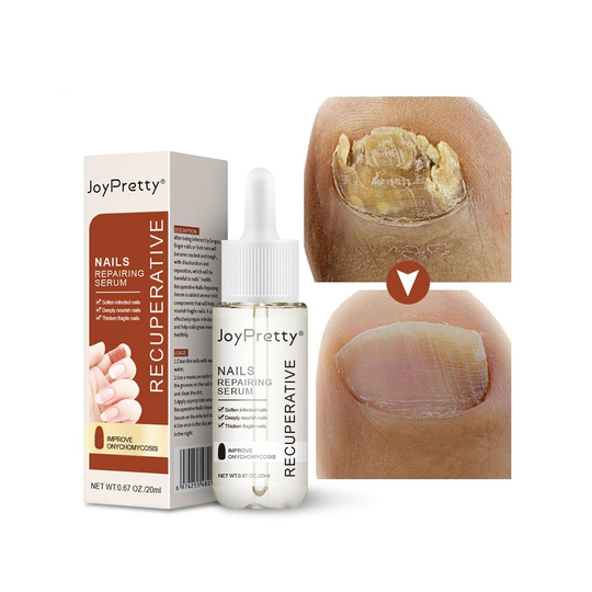Fungal Toe Nail Onychomycosis Treatment Serum Repair Fungus Removal