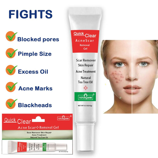 Quick Clear Acne Scar Removal Gel Skin Repair Tea Tree Oil Natureguess